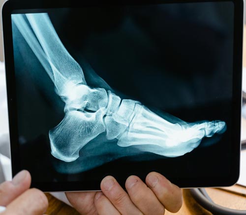 Randburg_Podiatry_yh_podiatry-9