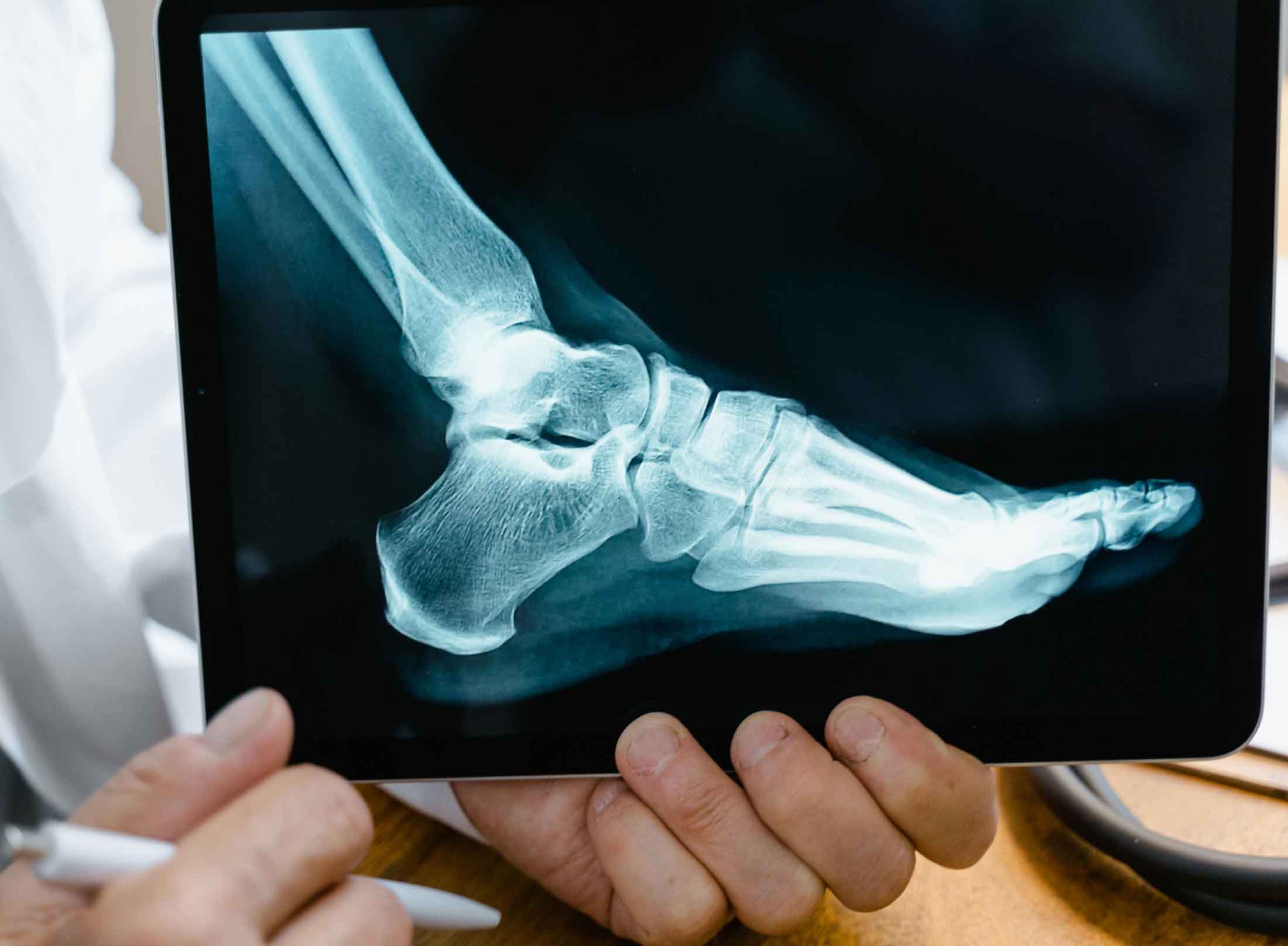 Podiatrist_in_Johannesburg_Flat_foot_2200 Podiatrist_in_Johannesburg_Flat_foot_2200