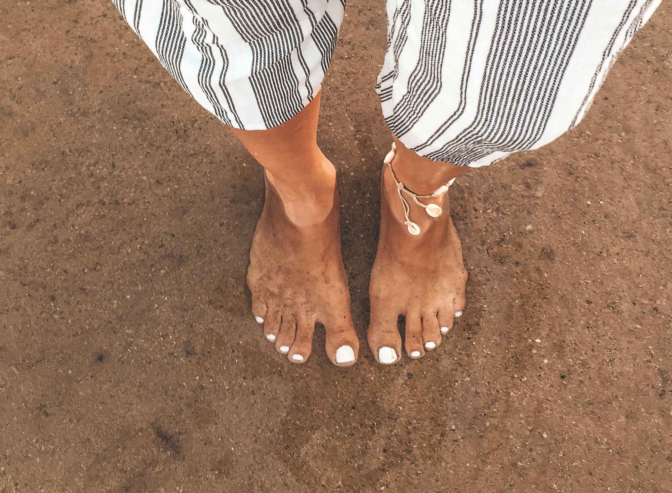 Podiatrist_in_Johannesburg_wart_feet_2200 Podiatrist_in_Johannesburg_wart_feet_2200